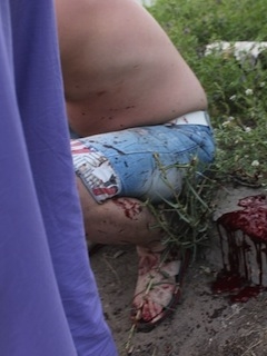 Жертва кровавой резни в Автограде