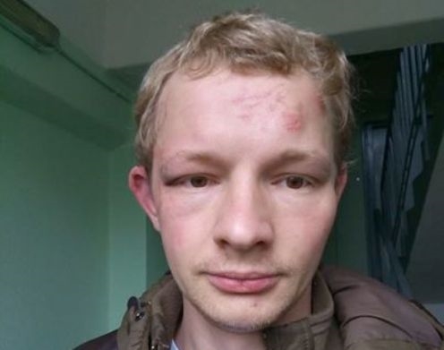 Тольяттинец Евгений Сямин после нападения в Москве 