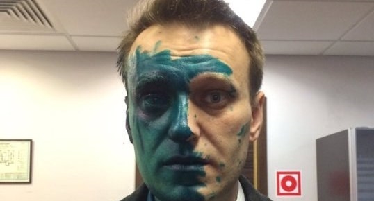 Алексей Навальный после атаки "зеленщика"