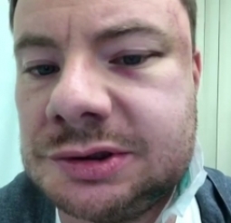 Андрей Ширман (DJ Smash) после нападения