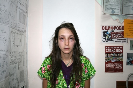 Амина Лесная после нападения неизвестного 
