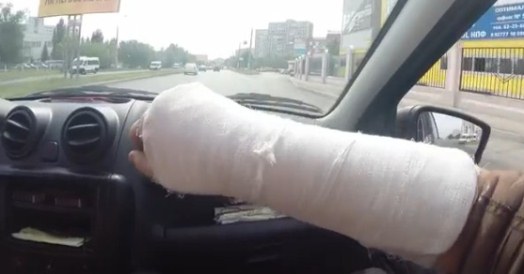 Юрий утверждает, что в полиции ему сломали руку