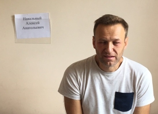 Навальный в палате 64-й больницы. Отек уже начал спадать 